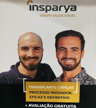 Insparya - Grupo Saúde Viável - Transplante Capilar - Processo inovador, eficaz e definitivo - AVALIAÇÃO GRATUITA